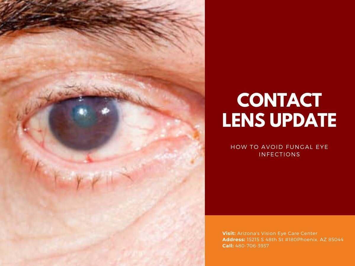 Contact Lens Update How To Avoid Fungal Eye Infections Eye Doctor