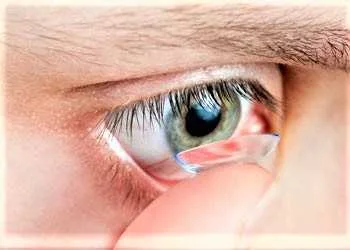 corneal reshaping contacts